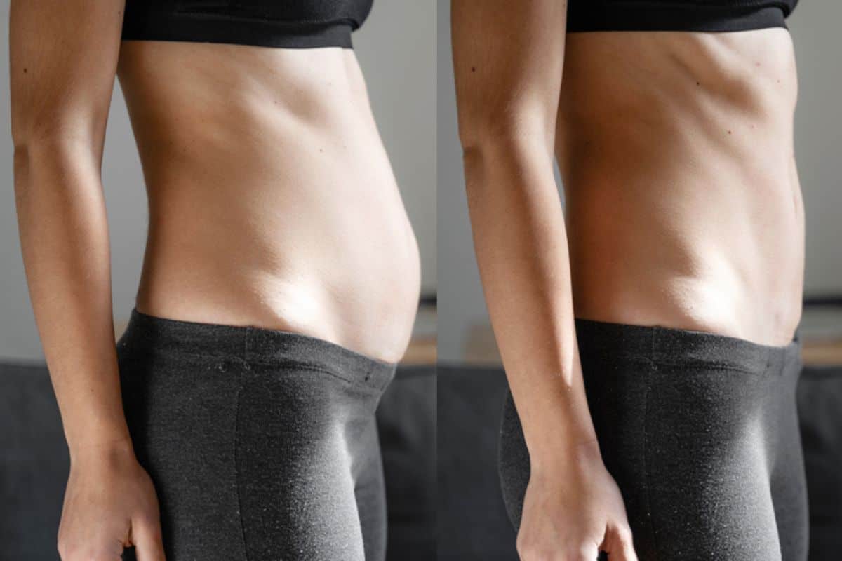 Post-Pregnancy: What Happens to Your Abdominal Muscles After Birth Rhyl