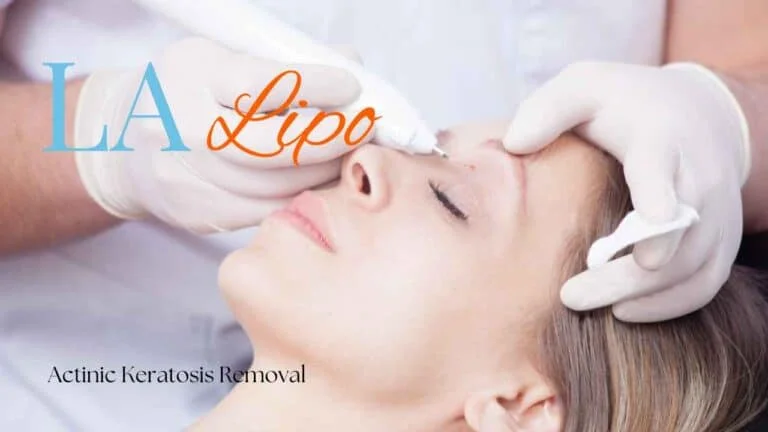 Woman receiving Actinic Keratosis Removal Treatment Rhyl