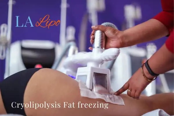 women getting fat freezing Rhyl