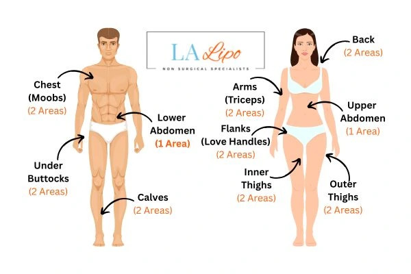 LA LIPO Cryolipolysis Areas Rhyl