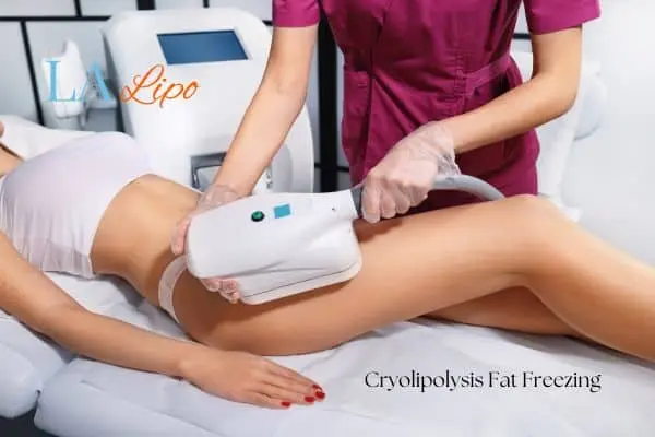 Woman receiving coolsculpting Rhyl treatment on her thighs