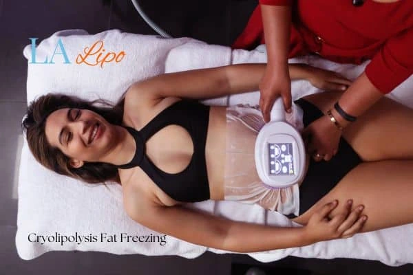 woman getting cryolipolysis Rhyl