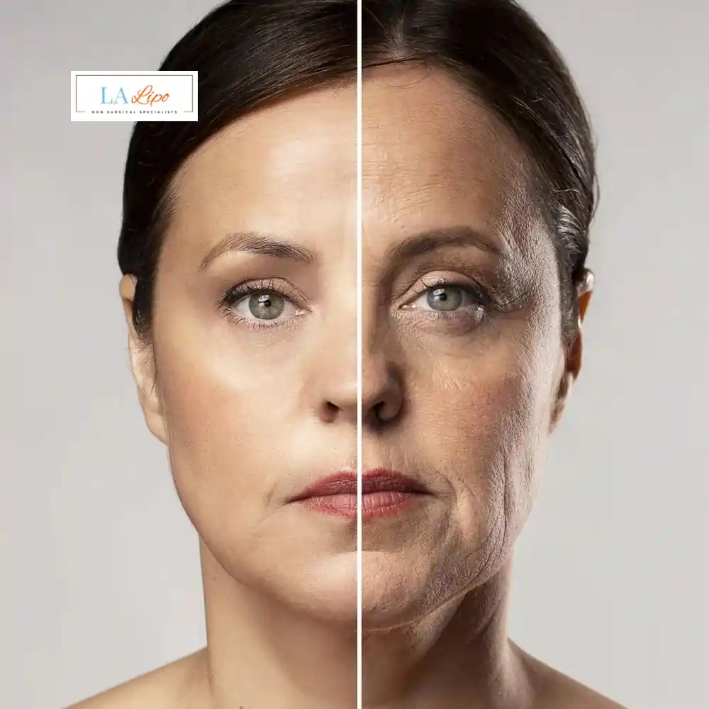 How Can You Tell If Non-Surgical Skin Tightening Is Right for You Rhyl?