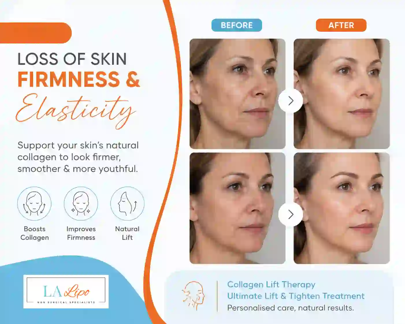 Sign #7: Loss of Skin Firmness and Elasticity Rhyl