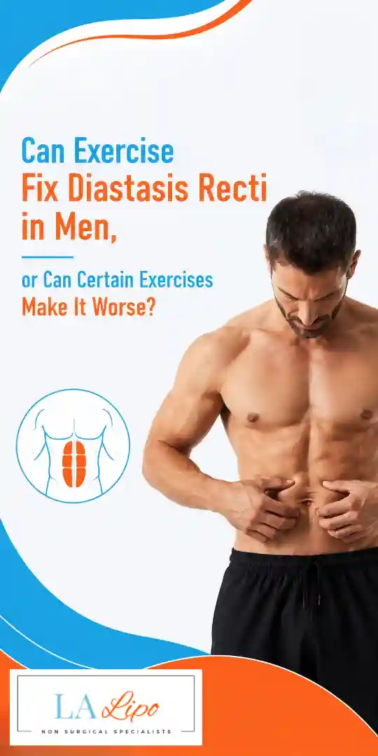 Can Exercise Fix Diastasis Recti in Men, or Can Certain Exercises Make It Worse Rhyl?